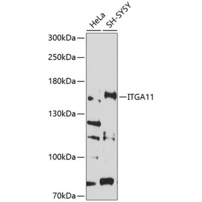 ITGA11 Rabbit Polyclonal Antibody