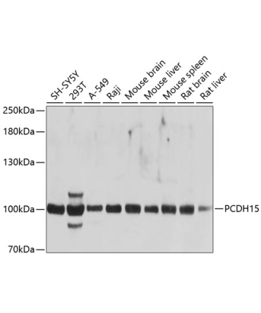 PCDH15 Rabbit Polyclonal Antibody