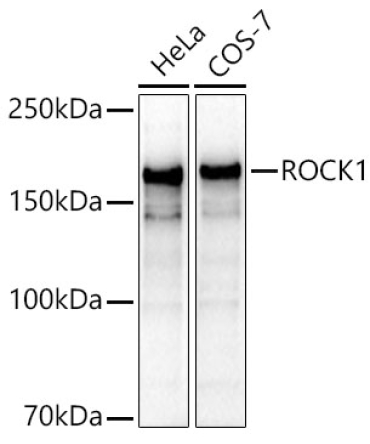 ROCK1 Rabbit Polyclonal Antibody [KO Validated]