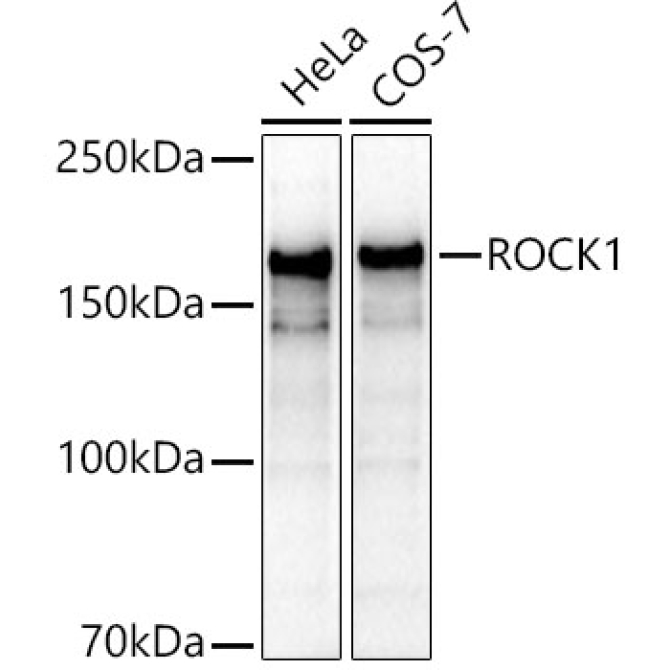 ROCK1 Rabbit Polyclonal Antibody [KO Validated]