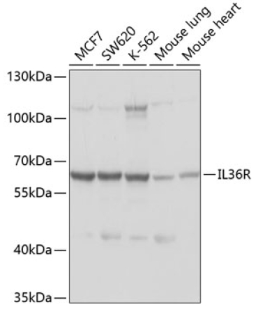 IL36R Rabbit Polyclonal Antibody