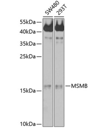 MSMB Rabbit Polyclonal Antibody