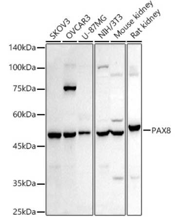 PAX8 Rabbit Polyclonal Antibody