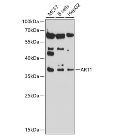 ART1 Rabbit Polyclonal Antibody