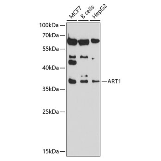 ART1 Rabbit Polyclonal Antibody