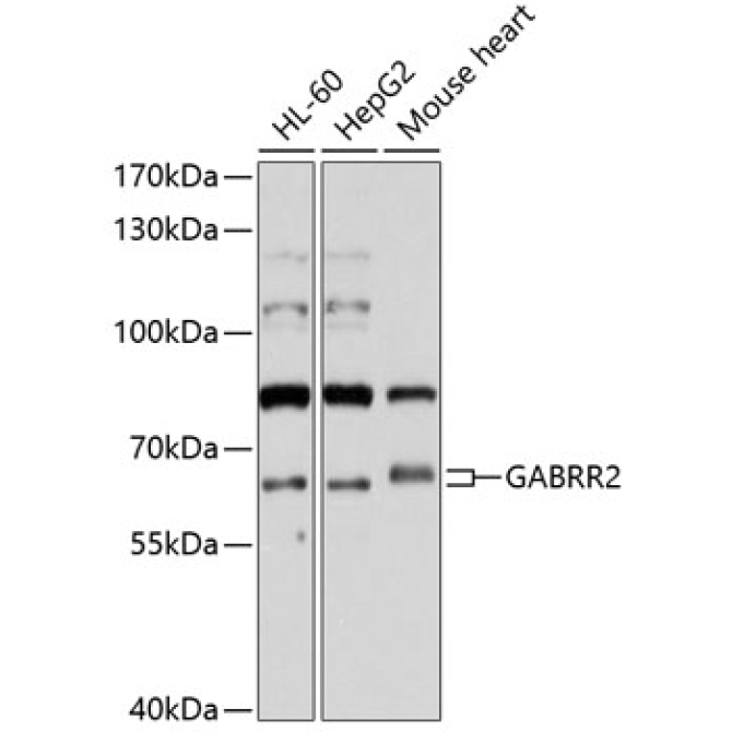 GABRR2 Rabbit Polyclonal Antibody