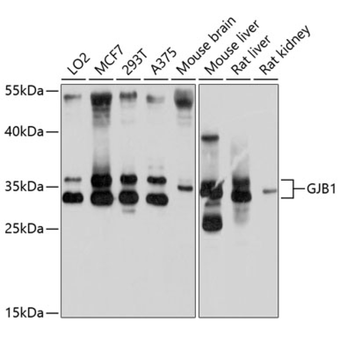 GJB1 Rabbit Polyclonal Antibody
