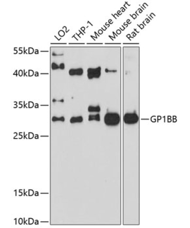 GP1BB Rabbit Polyclonal Antibody