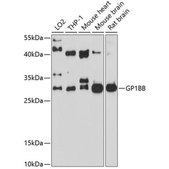 GP1BB Rabbit Polyclonal Antibody