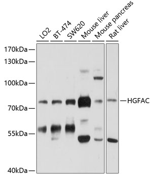 HGFAC Rabbit Polyclonal Antibody