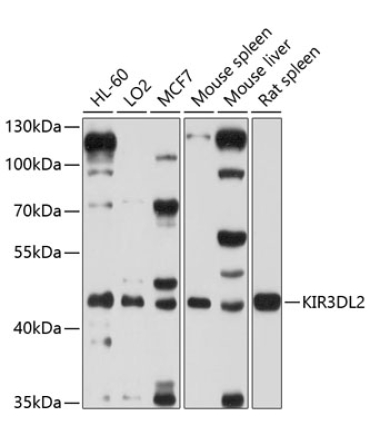 KIR3DL2 Rabbit Polyclonal Antibody