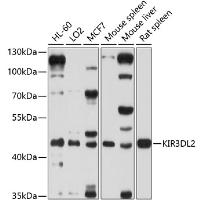 KIR3DL2 Rabbit Polyclonal Antibody