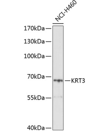 KRT3 Rabbit Polyclonal Antibody