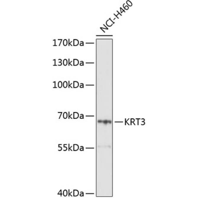 KRT3 Rabbit Polyclonal Antibody