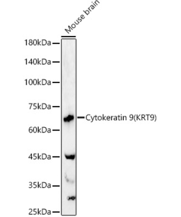Cytokeratin 9 (KRT9) Rabbit Polyclonal Antibody
