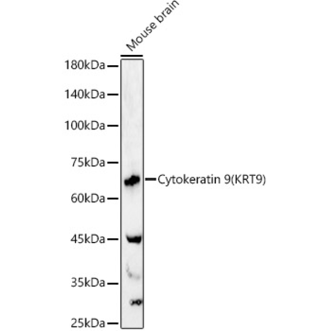 Cytokeratin 9 (KRT9) Rabbit Polyclonal Antibody