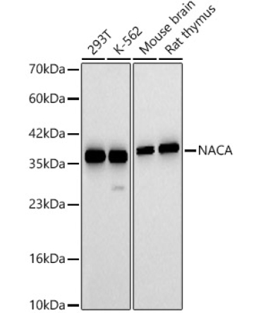 NACA Rabbit Polyclonal Antibody