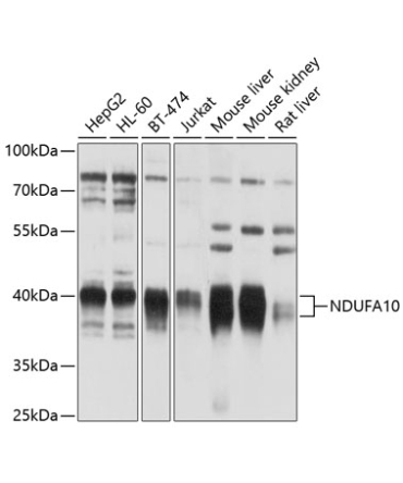NDUFA10 Rabbit Polyclonal Antibody