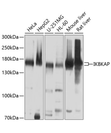 IKBKAP Rabbit Polyclonal Antibody
