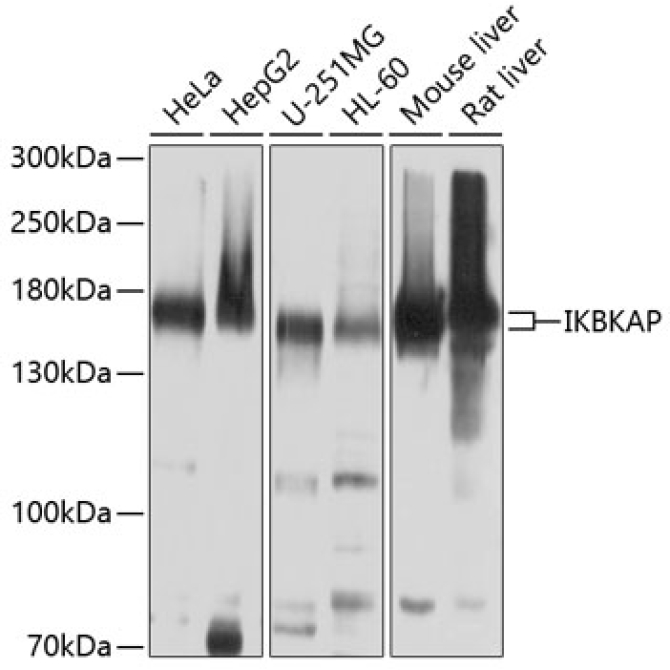 IKBKAP Rabbit Polyclonal Antibody