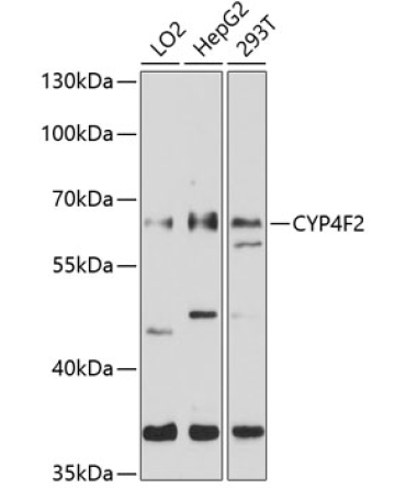 CYP4F2 Rabbit Polyclonal Antibody
