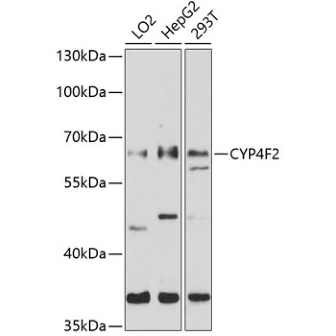 CYP4F2 Rabbit Polyclonal Antibody