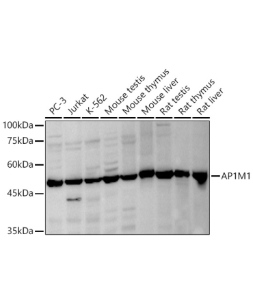 AP1M1 Rabbit Polyclonal Antibody