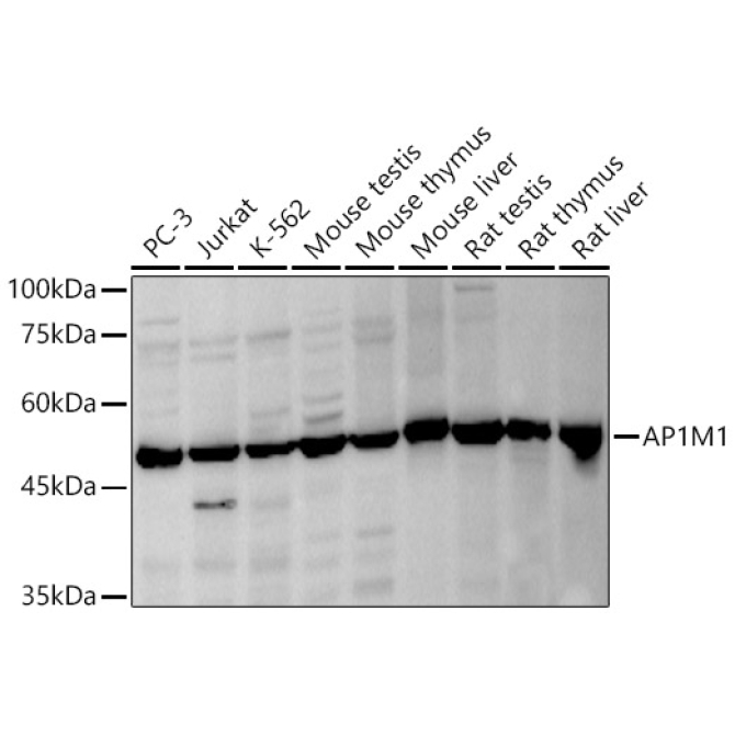 AP1M1 Rabbit Polyclonal Antibody