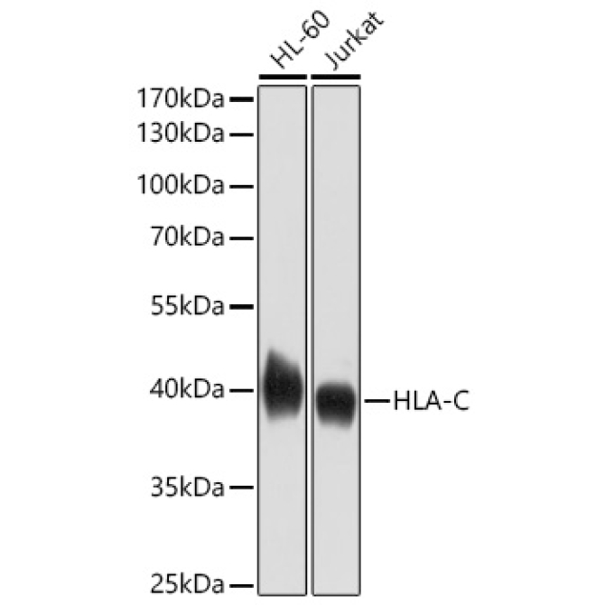 HLA-A+HLA-B+HLA-C Rabbit Polyclonal Antibody