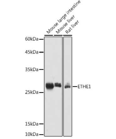 ETHE1 Rabbit Polyclonal Antibody
