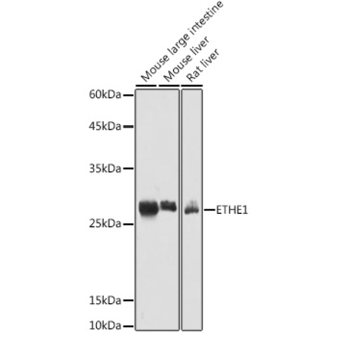 ETHE1 Rabbit Polyclonal Antibody