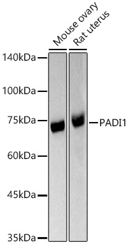 PADI1 Rabbit Polyclonal Antibody
