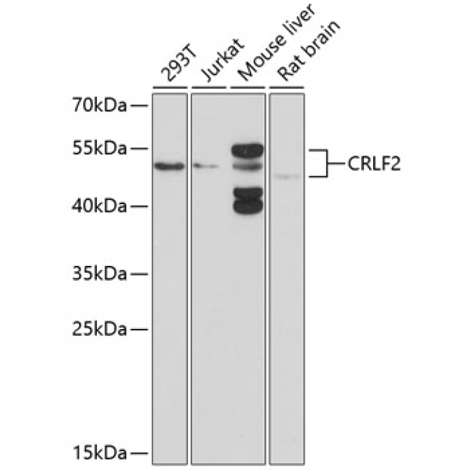 CRLF2 Rabbit Polyclonal Antibody