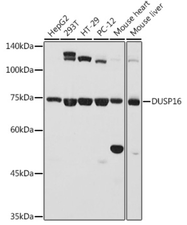 DUSP16 Rabbit Polyclonal Antibody