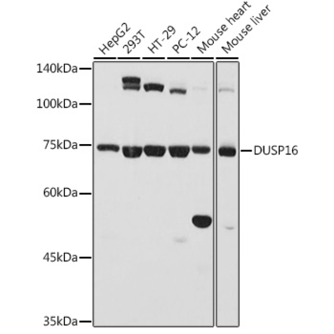 DUSP16 Rabbit Polyclonal Antibody