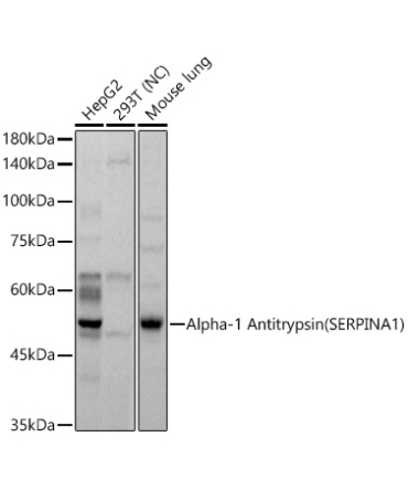 Alpha-1 Antitrypsin (SERPINA1) Rabbit Polyclonal Antibody