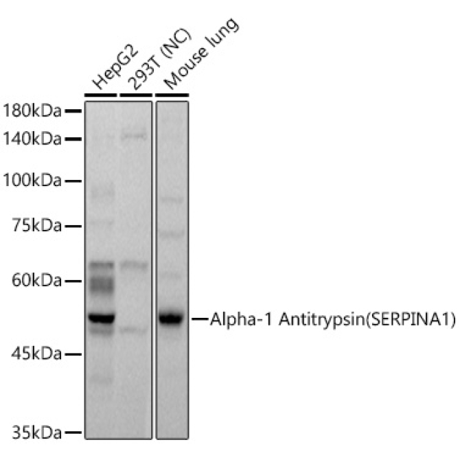 Alpha-1 Antitrypsin (SERPINA1) Rabbit Polyclonal Antibody