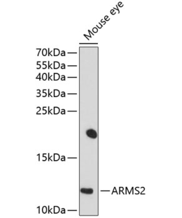 ARMS2 Rabbit Polyclonal Antibody