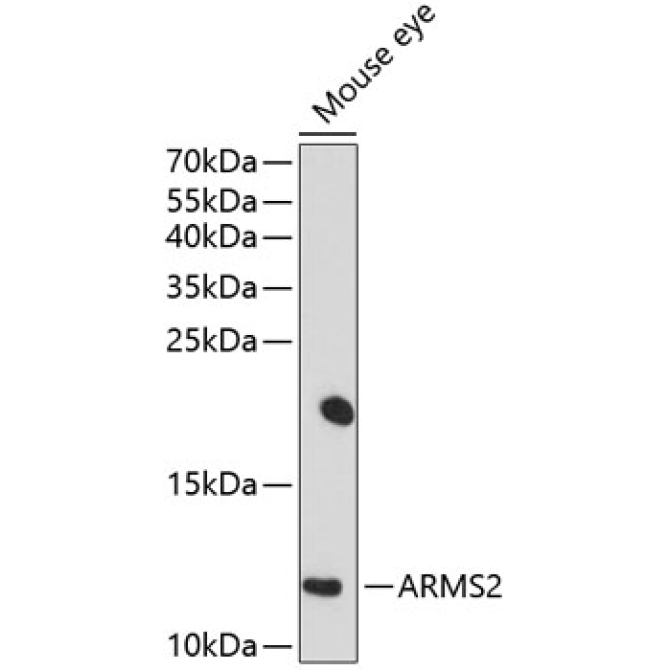 ARMS2 Rabbit Polyclonal Antibody