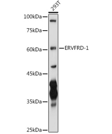 ERVFRD-1 Rabbit Polyclonal Antibody