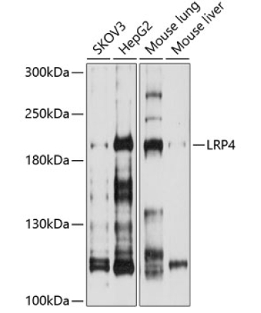 LRP4 Rabbit Polyclonal Antibody