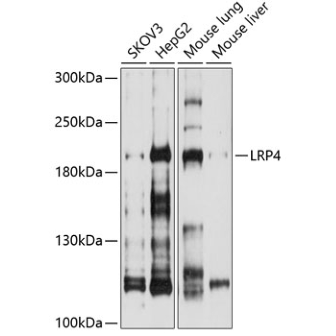 LRP4 Rabbit Polyclonal Antibody