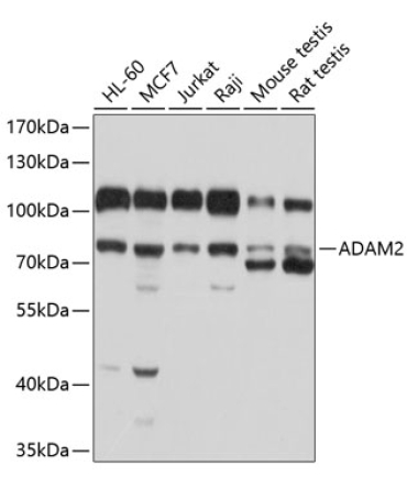 ADAM2 Rabbit Polyclonal Antibody