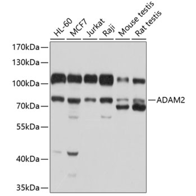ADAM2 Rabbit Polyclonal Antibody