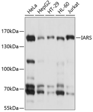 IARS Rabbit Polyclonal Antibody