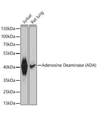 Adenosine Deaminase (ADA) Rabbit Polyclonal Antibody