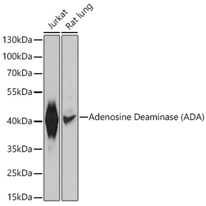 Adenosine Deaminase (ADA) Rabbit Polyclonal Antibody