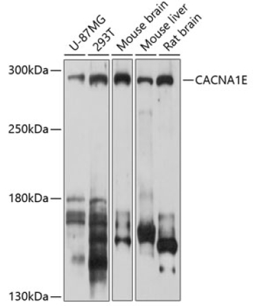 CACNA1E Rabbit Polyclonal Antibody