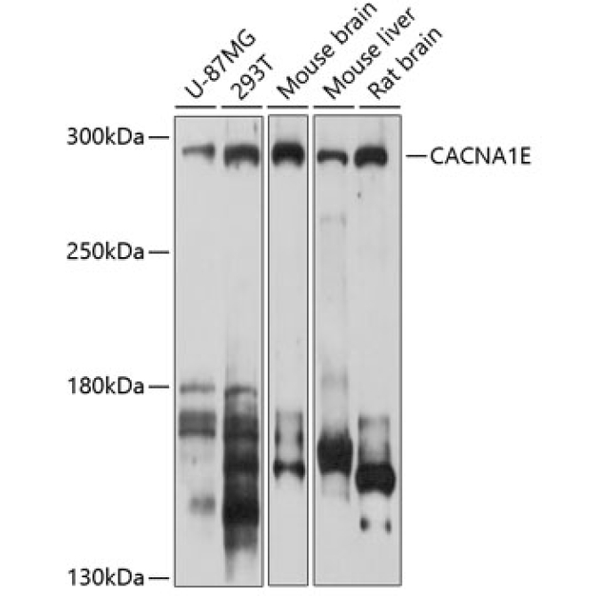 CACNA1E Rabbit Polyclonal Antibody
