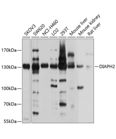 DIAPH2 Rabbit Polyclonal Antibody